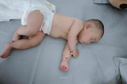 阳江六个月宝宝眼睛散光